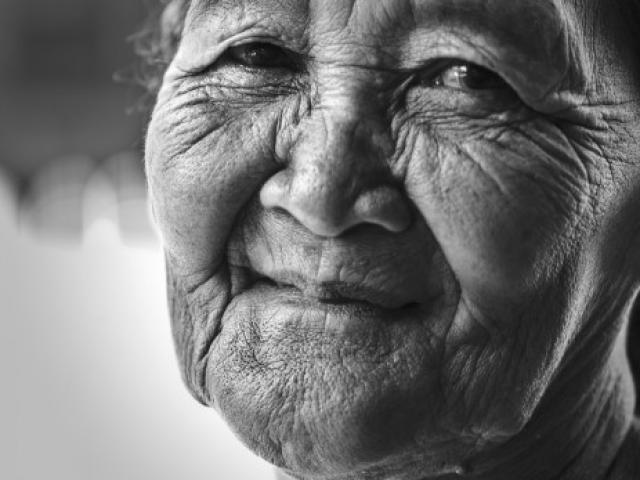 Tout savoir sur le vieillissement cutané : causes, effets, solutions